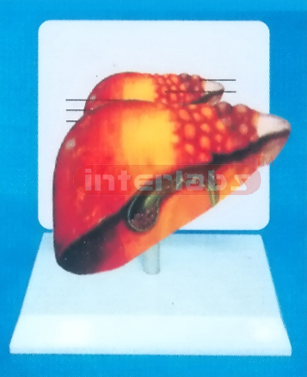 DESK TYPE HUMAN COMMON PATHOLOGIES OF LIVER MODEL WITH DESCRIPTION PLATE